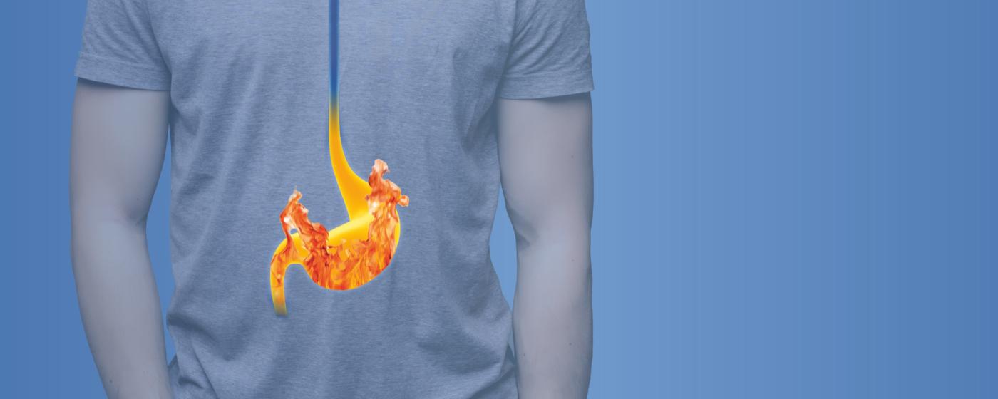Magenbrennen