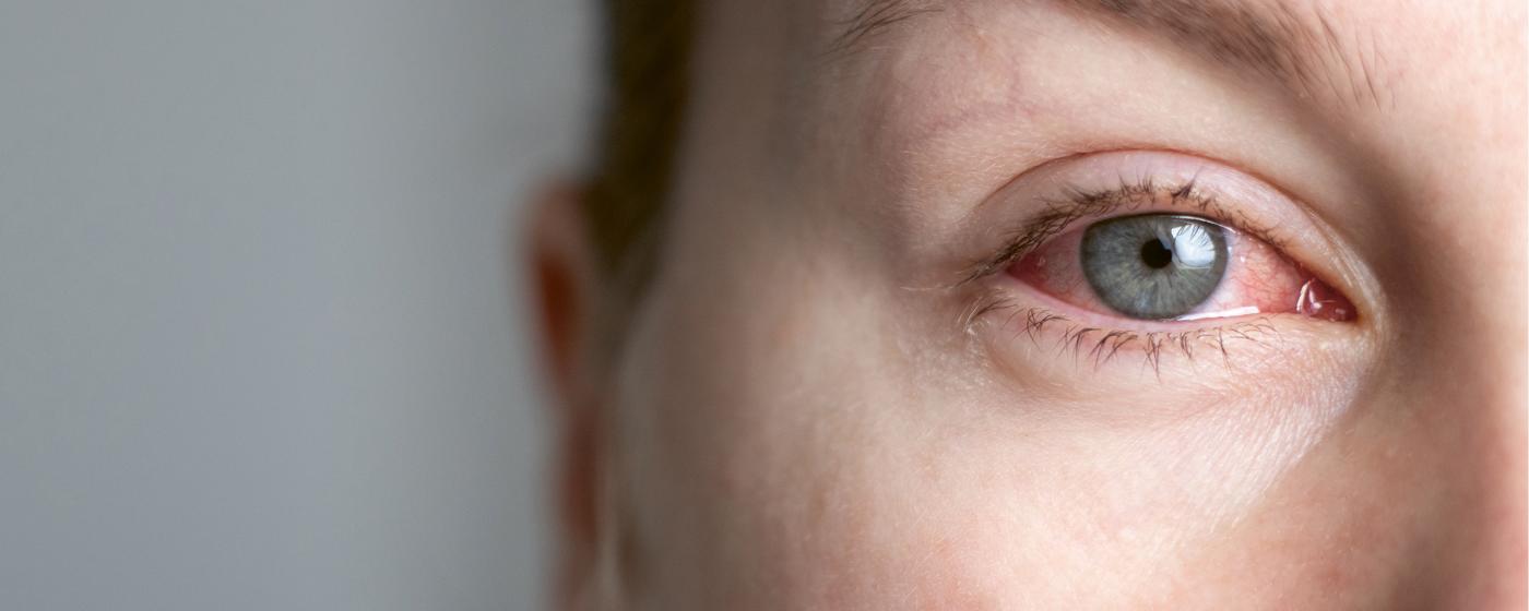 Auge